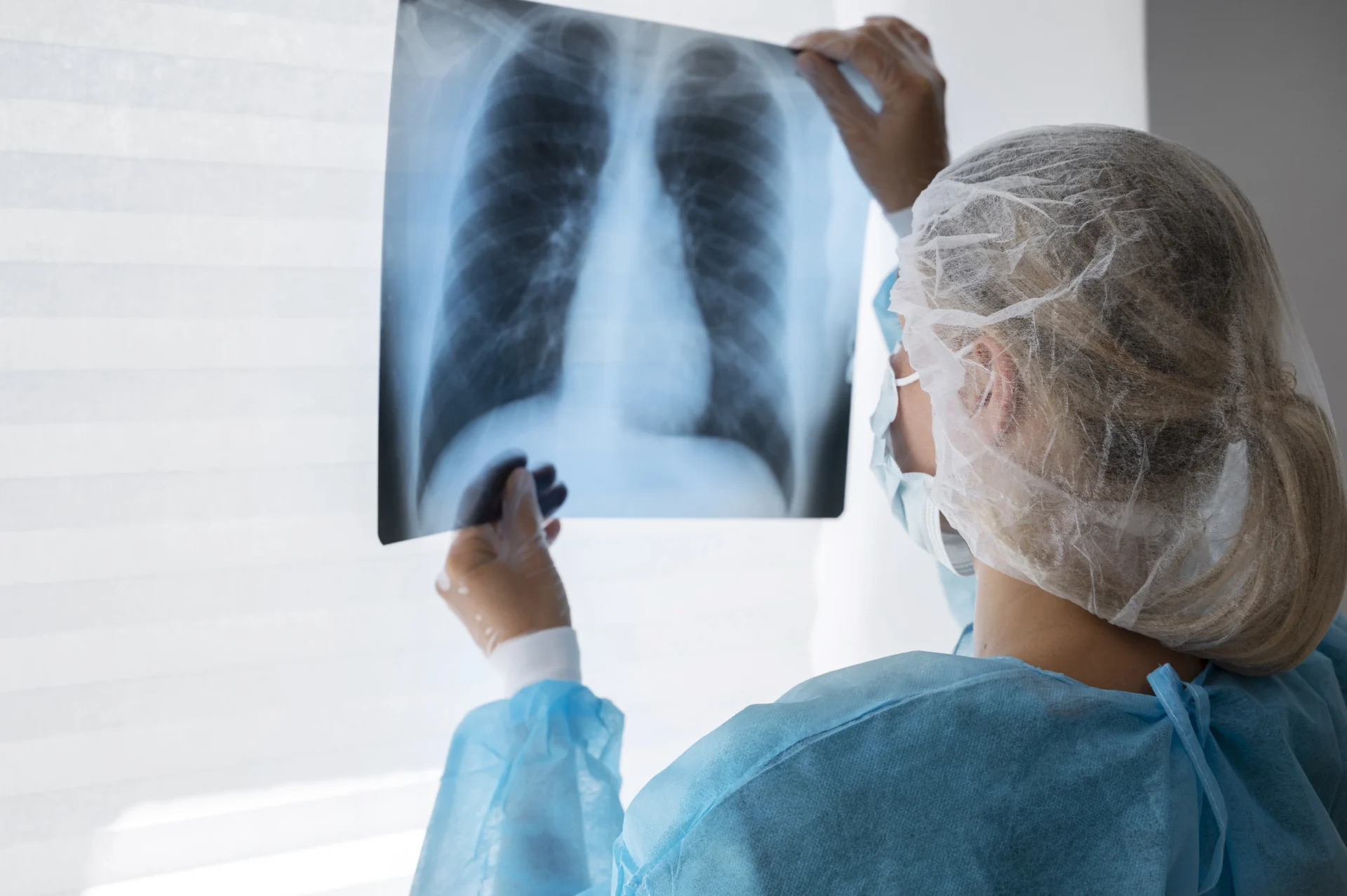Cancro Pulmão 2