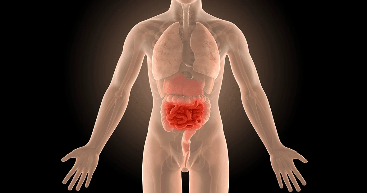 Doenca Doenca Crohn