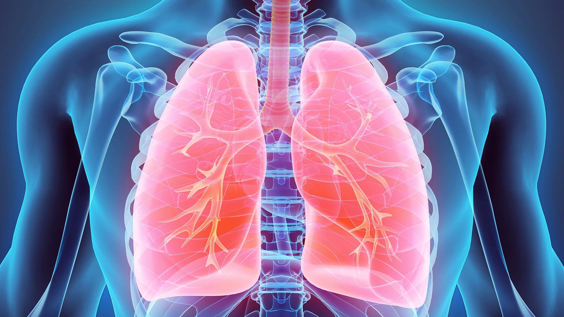 Doença Pulmonar Obstrutiva Crónica
