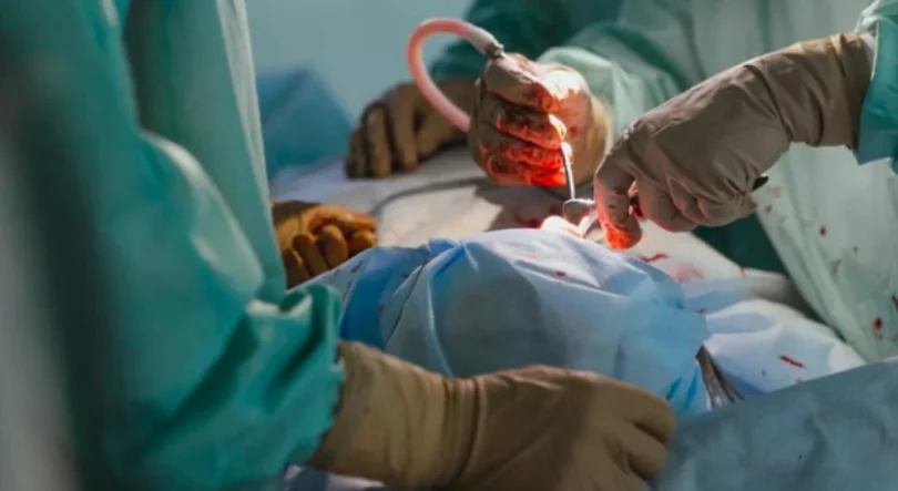 Transplante Renal